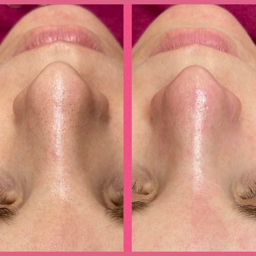 Crystal Beauty Szeged referencia